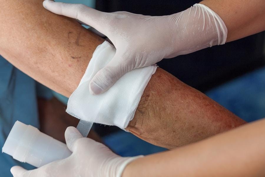 Wound Care